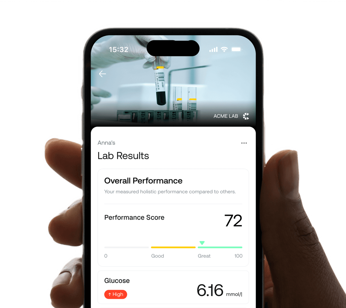 Clear results in the anomalie app